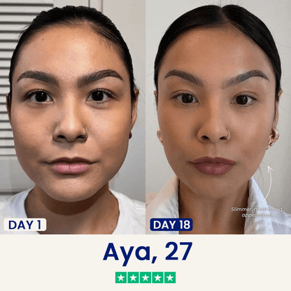 The Chinology™ Lift