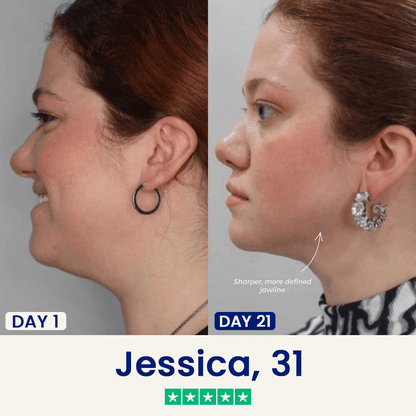 The Chinology™ Lift