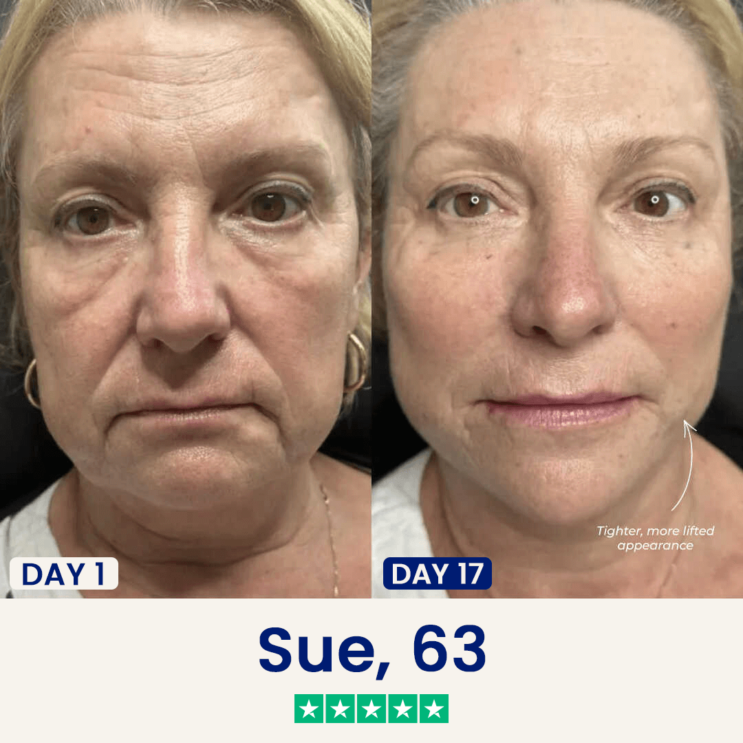 The Chinology™ Lift