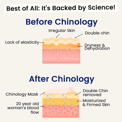 The Chinology™ Lift